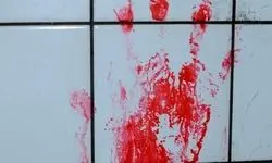 قاچاق هولناک اعضای بدن در تهران +جزئیات دلخراش