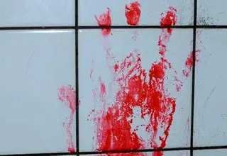 قاچاق هولناک اعضای بدن در تهران +جزئیات دلخراش