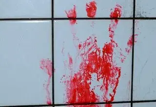 قاچاق هولناک اعضای بدن در تهران +جزئیات دلخراش