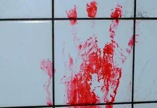 قاچاق هولناک اعضای بدن در تهران +جزئیات دلخراش